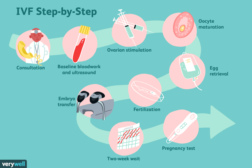 Τα βήματα της εξωσωματικής γονιμοποίησης σε infographic